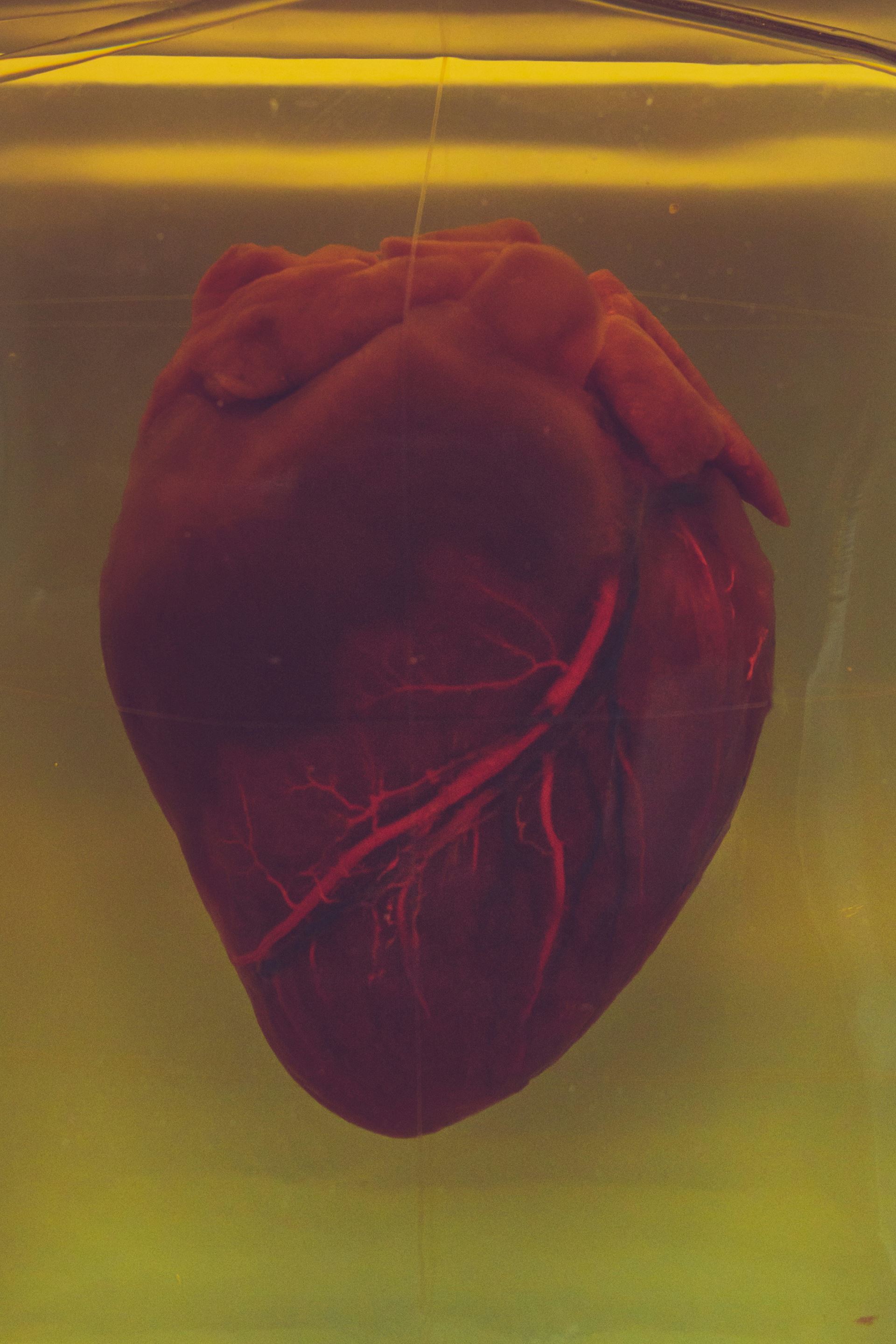 Calculate your heart age Your heart age gives you an idea of how healthy your heart is.